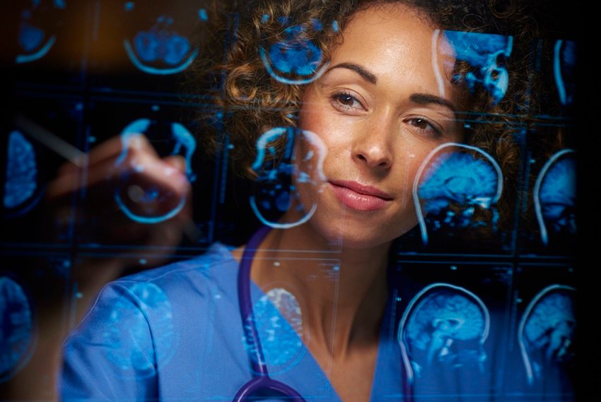 Imagem representativa da ligação entre a proteína alfa-sinucleína e a progressão da doença de Alzheimer em mulheres.