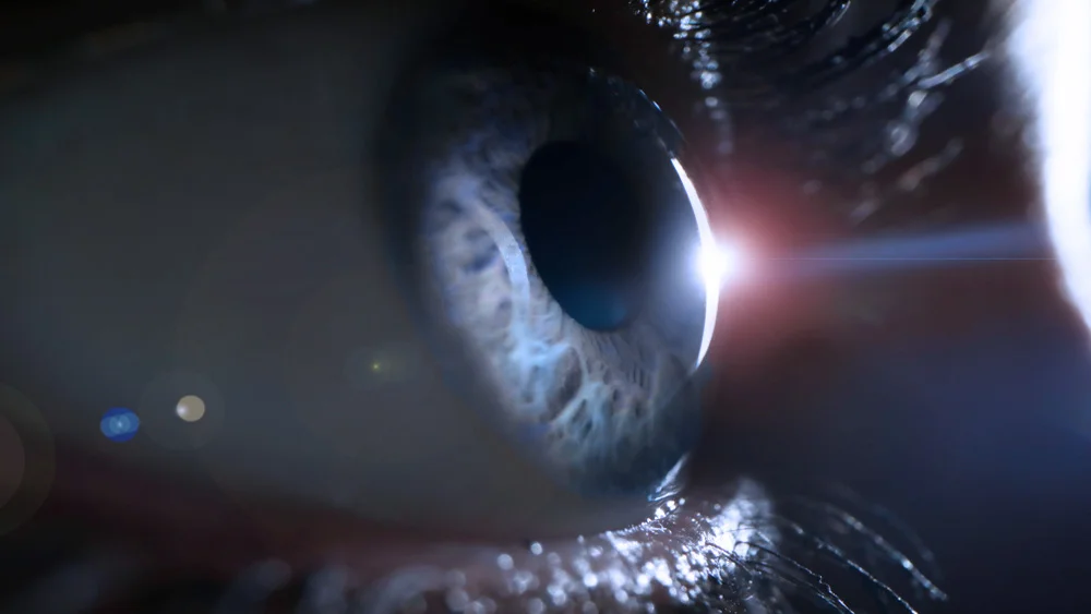 Imagem ilustrativa do descolamento da retina mostrando uma retina saudável e uma retina descolada.