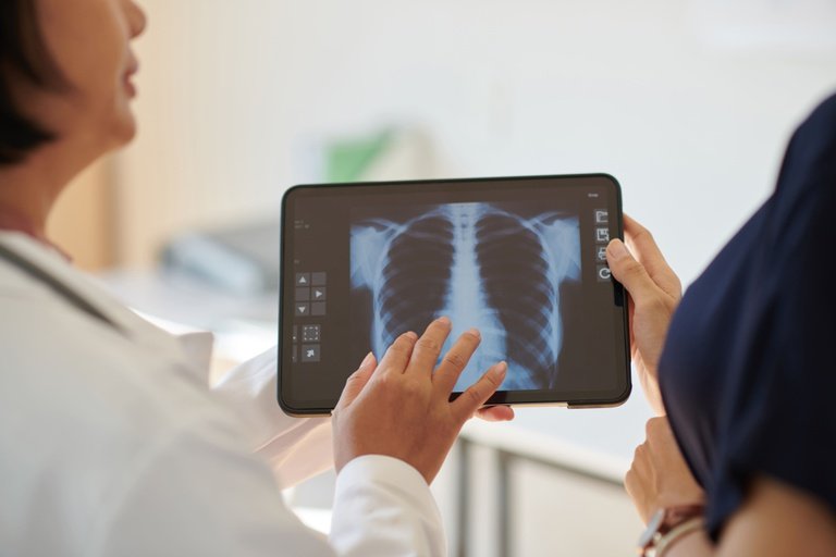 Novo medicamento Tyvaso aprovado pela Anvisa para tratamento da hipertensão pulmonar