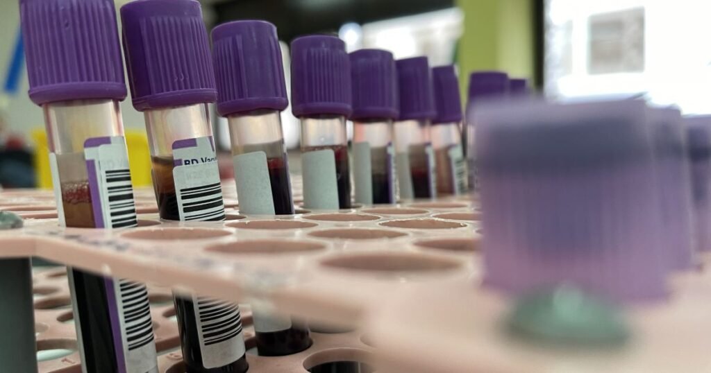 Ilustração de um laboratório realizando exames de sangue em pacientes sem jejum